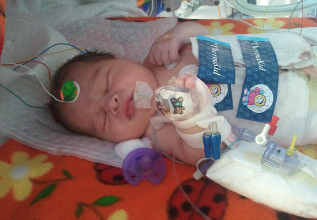 ΦΩΤΟ-Βρέφος “ξαναγεννήθηκε” αφού καταψύχθηκε