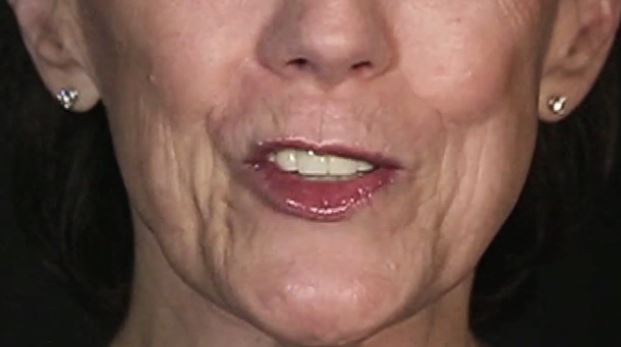 ΒΙΝΤΕΟ-Η φωνή πίσω από το Siri