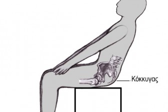 Κύστη Κόκκυγος: Ανώδυνη και ριζική λύση