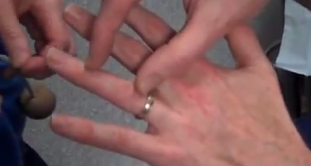 ΒΙΝΤΕΟ-Πώς να βγάλεις ένα δαχτυλίδι