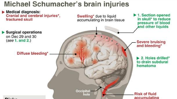 Το διάγραμμα του γαλλικού πρακτορείου για τον Σουμάχερ