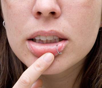 Piercing: Οι κίνδυνοι για το στόμα