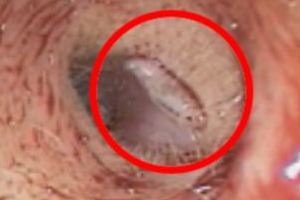 ΒΙΝΤΕΟ-Ζει μέσα στο αυτί της