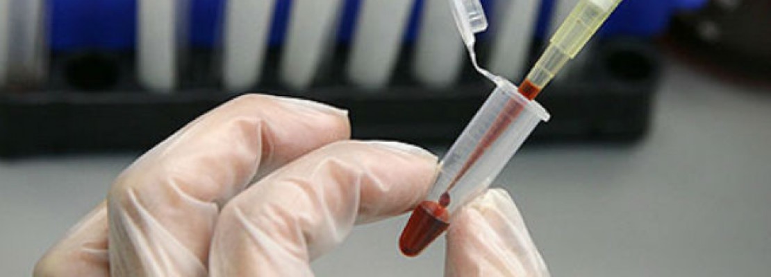 Το τεστ του αποκαλύπτει αν μας… ενεδρεύει ο θάνατος