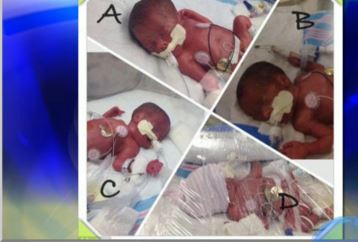 Το έμβρυο που εξέθεσε τους γιατρούς