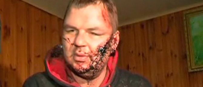 Σημάδια βασανισμού φέρει ο Ουκρανός ακτιβιστής