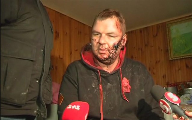 Σε νοσοκομείο του Βίλνιους ο Μπουλάτοφ