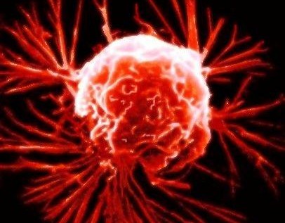 Η σοβαρή ασθένεια που οι Ευρωπαίοι αγνοούν