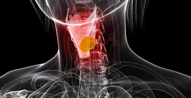 Υποθυρεοειδισμός: Ποια είναι τα συμπτώματα και ποιοι κινδυνεύουν;