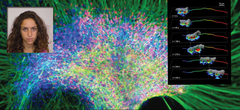 Ελληνίδα ερευνά τη θεραπεία χρόνιων φλεγμονωδών παθήσεων