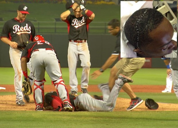 ΒΙΝΤΕΟ-Απίστευτος τραυματισμός από μπαλάκι