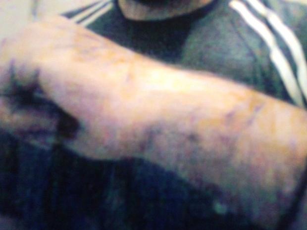 ΦΩΤΟ-Καταγγελία για ξυλοδαρμό μέσα στο αστυνομικό τμήμα