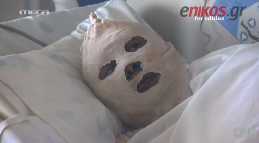 ΒΙΝΤΕΟ-Αυτοπυρπολήθηκε γιατί δεν έβρισκε φαγητό για τα παιδιά της