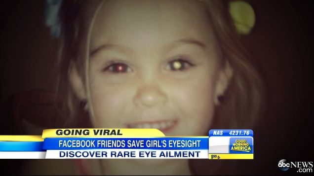 Το Facebook… έσωσε κοριτσάκι από τύφλωση