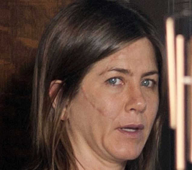 Ποιος χαράκωσε την Άνιστον;