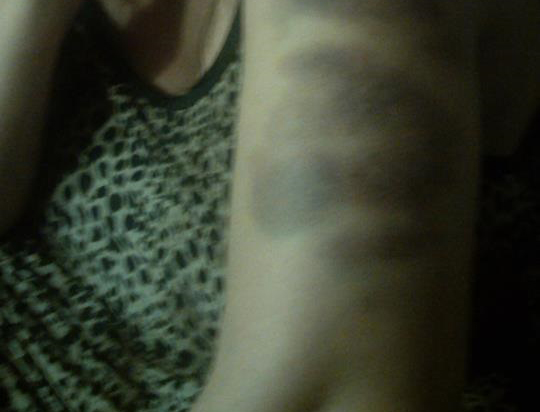 “Με χτύπησαν για να μην κατέβω στις εκλογές”