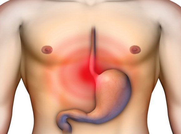 Όταν τρώω έχω καούρες. Πως θα ανακουφιστώ;