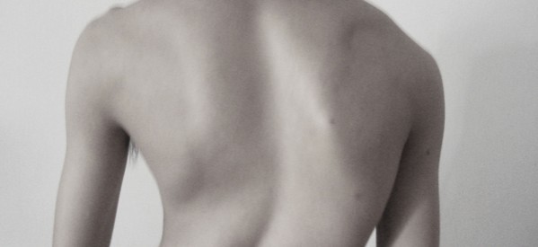 Πως καταλαβαίνω αν το παιδί μου έχει σκολίωση;