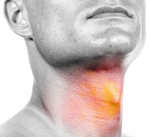 Φαρυγγο-λαρυγγική παλινδρόμηση