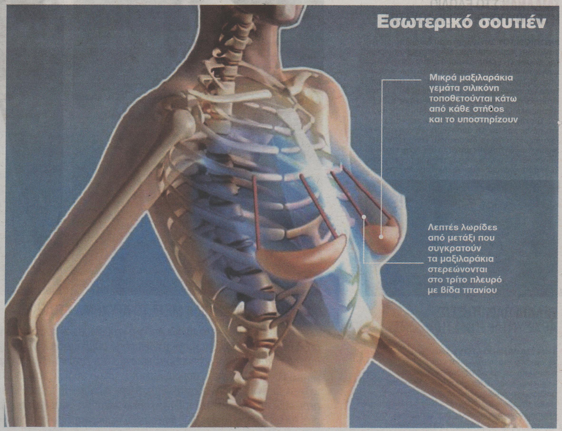 Νεανικό και σφριγηλό στήθος με «αόρατο σουτιέν»