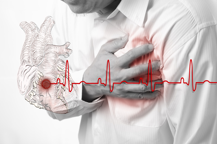 Η καρδιά προστατεύεται όταν υπάρχει πόνος πριν την καρδιακή προσβολή