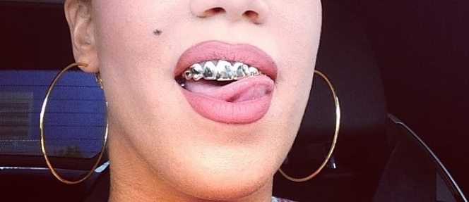 ΦΩΤΟ-Ποια Ελληνίδα τραγουδίστρια έβαλε σιδεράκια;