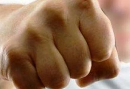 Πλήρωσε 250.000 δολ. για φωτογραφίες από καυγά