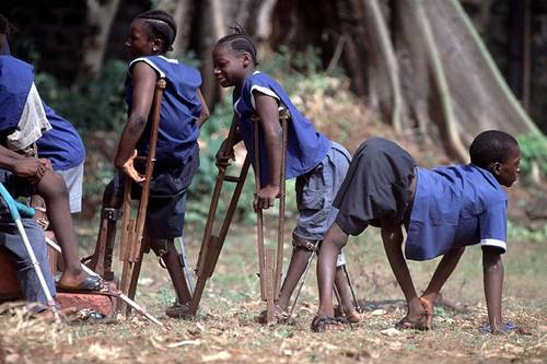 ΠΟΥ: «Κατάσταση έκτακτης ανάγκης» για την πολιομυελίτιδα