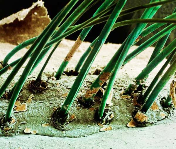 perierga.gr - Το ανθρώπινο σώμα στο μικροσκόπιο!