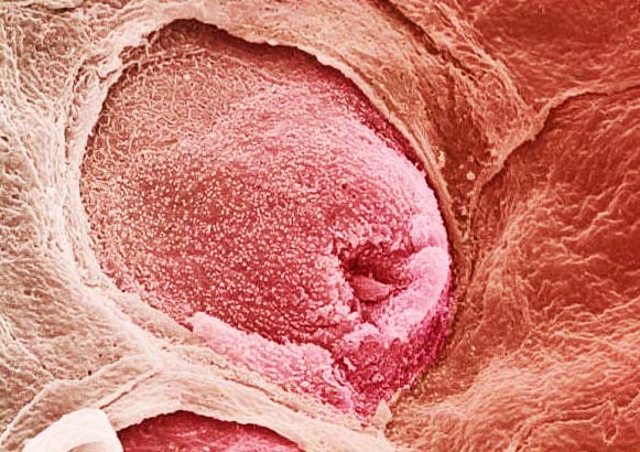 perierga.gr - Το ανθρώπινο σώμα στο μικροσκόπιο!