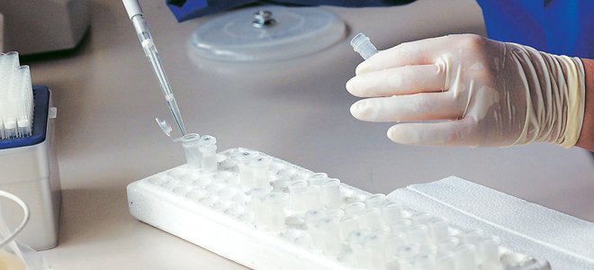 Ανακάλυψαν γονίδιο που φέρνει περισσότερη εξυπνάδα