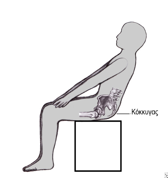 Κύστη κόκκυγος: Aνώδυνο τέλος με ραδιοσυχνότητες