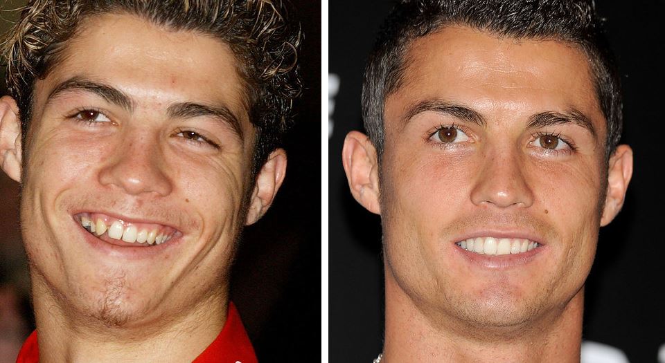 ΦΩΤΟ-Διάσημοι σταρ πριν και μετά τον… οδοντίατρο