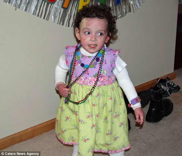 6χρονη πάσχει από σπάνια ασθένεια-Πληγώνεται με μια αγκαλιά