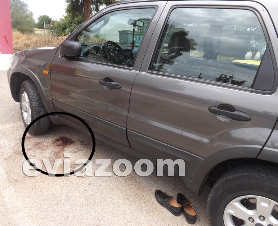 ΦΩΤΟ-Βγήκαν τα μαχαίρια σε στριπτιζάδικο