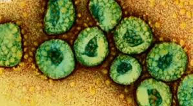 Ένας νεκρός από τον κορονοϊό MERS στην Αλγερία