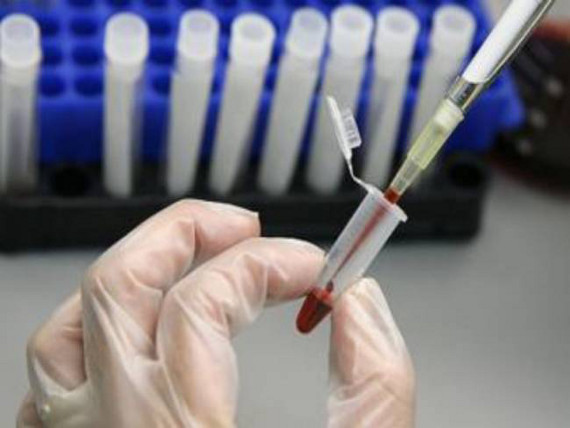 Νέα εξέταση αίματος προβλέπει τον κίνδυνο εμφάνισης του καρκίνου του μαστού