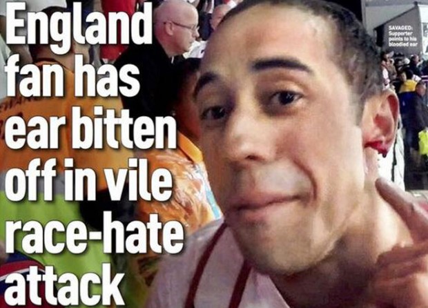 Έφαγε το μισό αυτί οπαδού της Αγγλίας