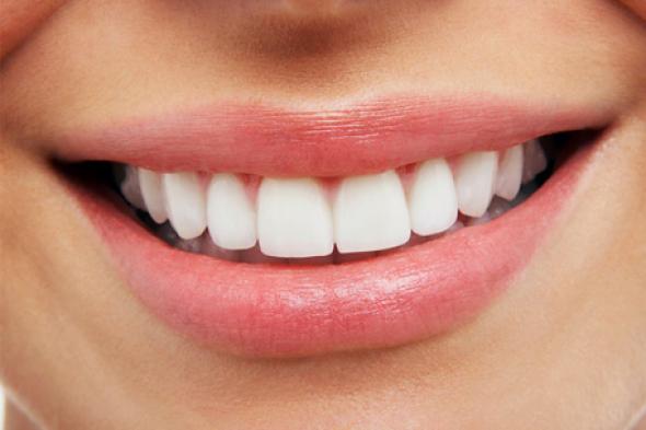 Όψεις ρητίνης: Υπερτερούν των όψεων πορσελάνης;