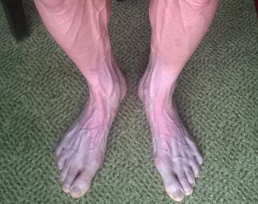 ΦΩΤΟ-Τα πόδια ενός ποδηλάτη στο Tour de France