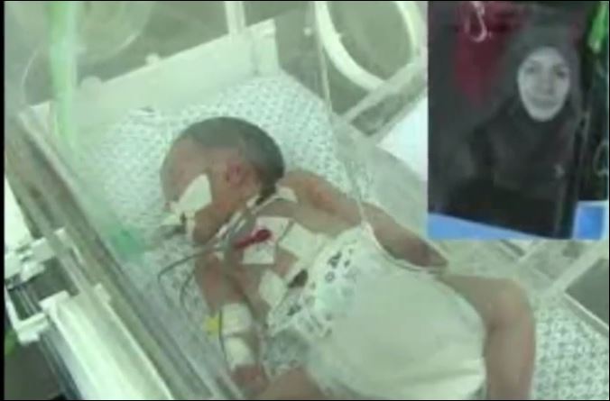 ΒΙΝΤΕΟ-Πέθανε το “μωρό-θαύμα” της Γάζας