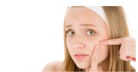 Ακμή το καλοκαίρι: Μία αποτελεσματική θεραπεία χωρίς φάρμακα