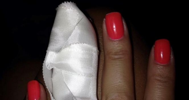 ΦΩΤΟ-Το “ατύχημα” Ελληνίδας ηθοποιού