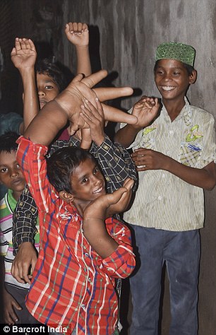 The eight-year-old claims he is bullied because of his giant hands and has difficulty performing simple tasks