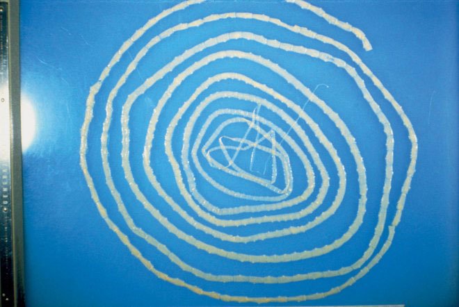 Τάισε την κ��ρη της σκουλήκια για να …αδυνατίσει