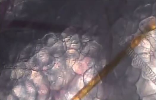 ΒΙΝΤΕΟ-Τι παθαίνει το σώμα μας όταν δέχεται επίθεση κουνουπιού