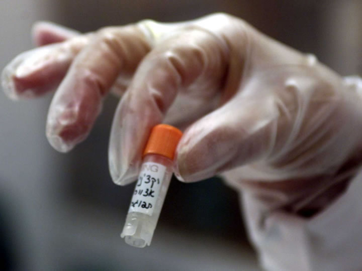 Το πειραματικό φάρμακο για τον Έμπολα “έπιασε” στους πιθήκους