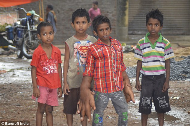 ΦΩΤΟ-Αγοράκι με χέρια γίγαντα