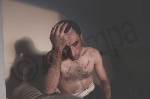 ΦΩΤΟ-Ρατσιστική επίθεση σε Ιρανό με 16 μαχαιριές