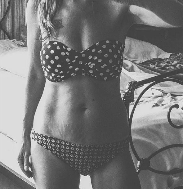 Νέο κίνημα στο instagram: “Αγάπησε τις ραγάδες σου”